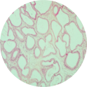 Vesicular Gland